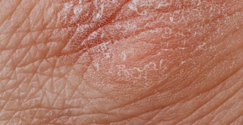 close up view of human dry skin