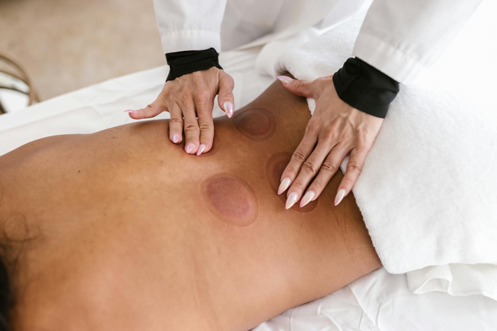 a person massaging a ventosa cup marks on a patient s back